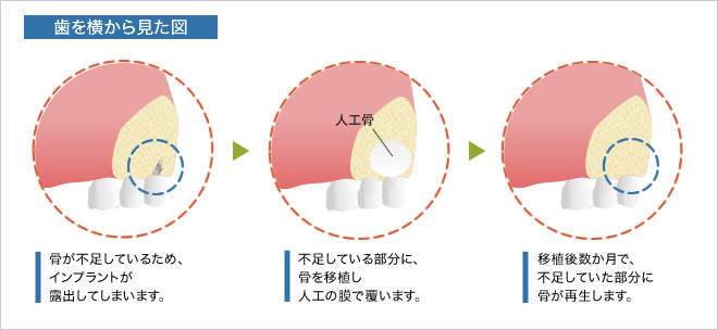 歯を横から見た図